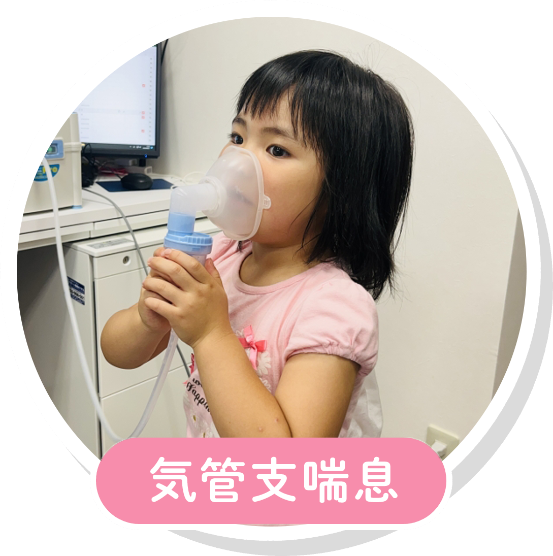気管支喘息
