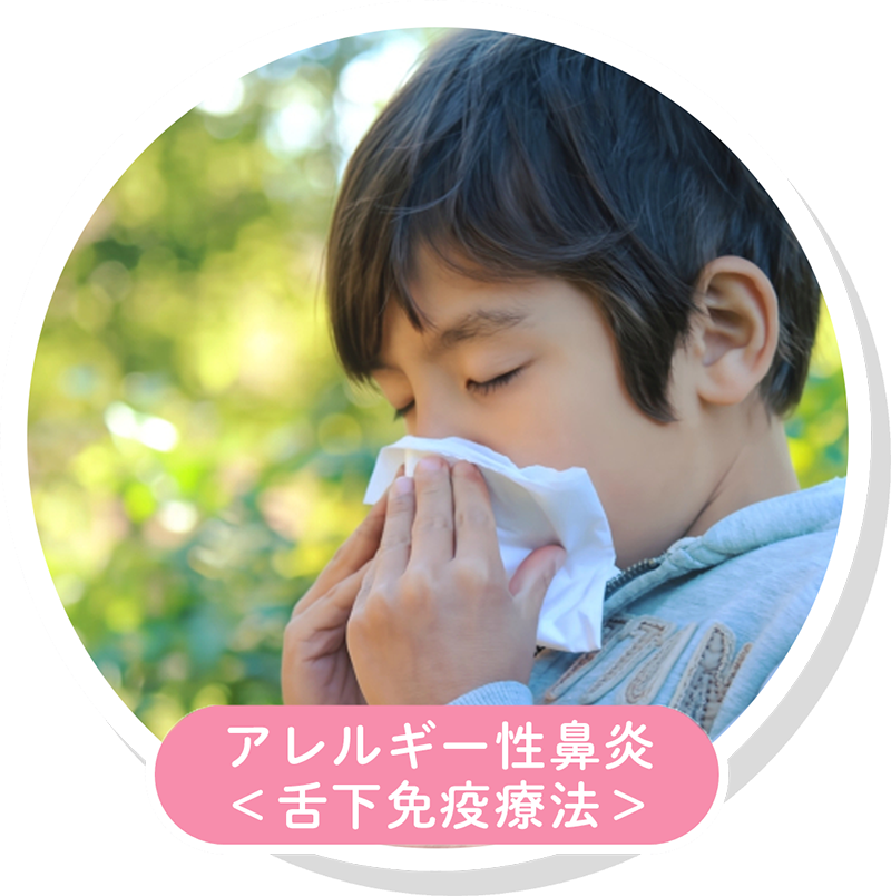 アレルギー性鼻炎 舌下免疫療法
