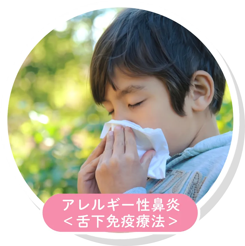 アレルギー性鼻炎 舌下免疫療法