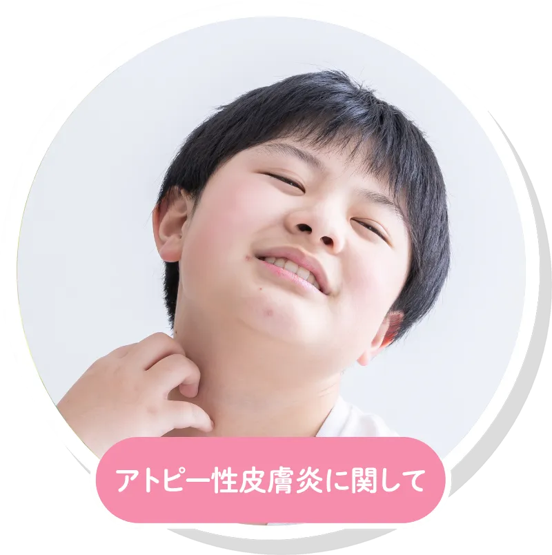アトピー性皮膚炎に関して